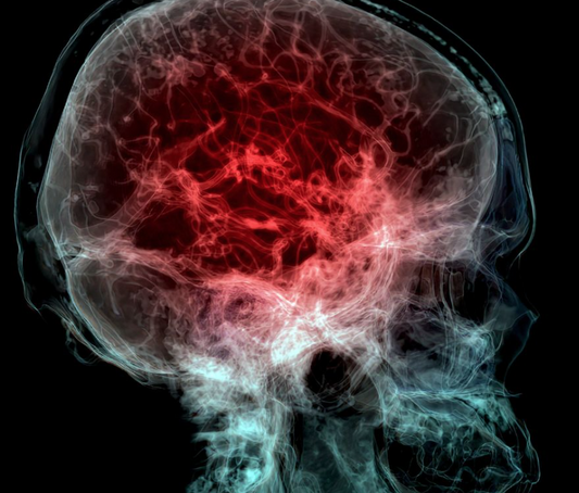 Microplásticos y nanoplásticos acumulados en el cerebro humano según estudio publicado en Nature Medicine 2024